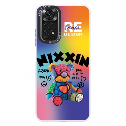 Newface Xiaomi Redmi Note 11S Kılıf Estoril Desenli Kapak - Estoril - 11 Newface Xiaomi Redmi Note 11S Kılıf Estoril Desenli Kapak - Estoril - 11