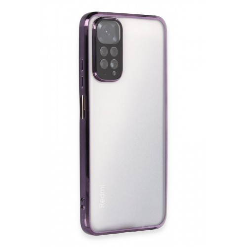 Newface Xiaomi Redmi Note 11 Kılıf Razer Lensli Silikon - Mor Newface Xiaomi Redmi Note 11 Kılıf Razer Lensli Silikon - Mor