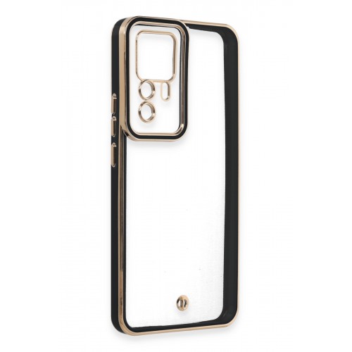 Newface Xiaomi Mi 12T Kılıf Liva Lens Silikon - Siyah Newface Xiaomi Mi 12T Kılıf Liva Lens Silikon - Siyah