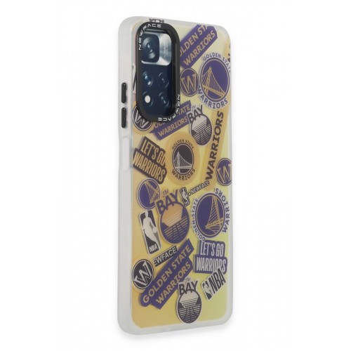 Newface Xiaomi Redmi Note 11 Pro Kılıf Estoril Desenli Kapak - Estoril - 13 Newface Xiaomi Redmi Note 11 Pro Kılıf Estoril Desenli Kapak - Estoril - 13