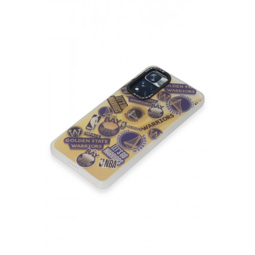 Newface Xiaomi Redmi Note 11 Pro Kılıf Estoril Desenli Kapak - Estoril - 13 Newface Xiaomi Redmi Note 11 Pro Kılıf Estoril Desenli Kapak - Estoril - 13
