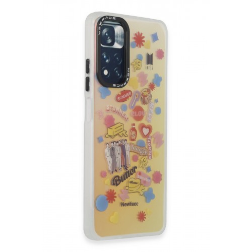 Newface Xiaomi Redmi Note 11 Pro Kılıf Estoril Desenli Kapak - Estoril - 16 Newface Xiaomi Redmi Note 11 Pro Kılıf Estoril Desenli Kapak - Estoril - 16