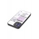 Newface iPhone 11 Kılıf Mirror Desenli Kapak - Mirror - 4 Newface iPhone 11 Kılıf Mirror Desenli Kapak - Mirror - 4