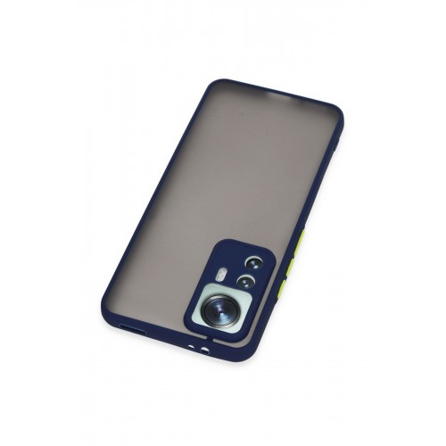 Newface Xiaomi Mi 12T Kılıf Montreal Silikon Kapak - Lacivert Newface Xiaomi Mi 12T Kılıf Montreal Silikon Kapak - Lacivert