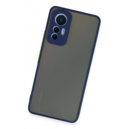 Newface Xiaomi Mi 12 Lite Kılıf Montreal Silikon Kapak - Lacivert Newface Xiaomi Mi 12 Lite Kılıf Montreal Silikon Kapak - Lacivert