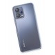 Newface Xiaomi Redmi Note 12 5G Kılıf Razer Lensli Silikon - Açık Mavi