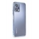 Newface Xiaomi Redmi Note 12 5G Kılıf Razer Lensli Silikon - Açık Mavi