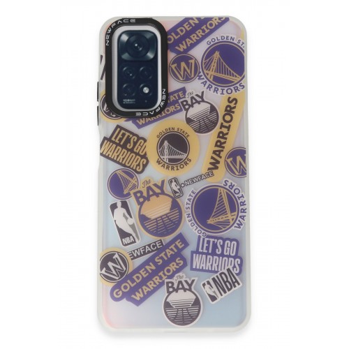 Newface Xiaomi Redmi Note 11S Kılıf Estoril Desenli Kapak - Estoril - 13 Newface Xiaomi Redmi Note 11S Kılıf Estoril Desenli Kapak - Estoril - 13
