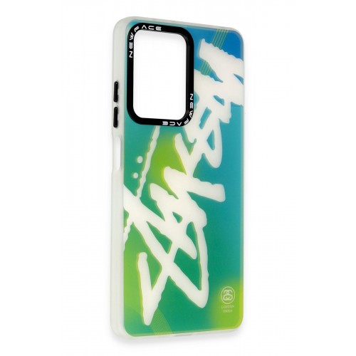 Newface Xiaomi Redmi Note 12 4G Kılıf Estoril Desenli Kapak - Estoril - 2 Newface Xiaomi Redmi Note 12 4G Kılıf Estoril Desenli Kapak - Estoril - 2