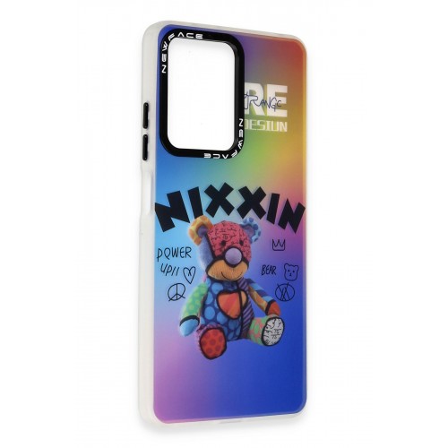Newface Xiaomi Redmi Note 12 4G Kılıf Estoril Desenli Kapak - Estoril - 11 Newface Xiaomi Redmi Note 12 4G Kılıf Estoril Desenli Kapak - Estoril - 11