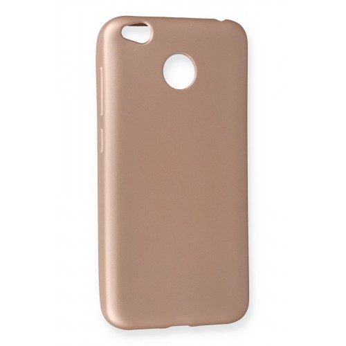 Newface Xiaomi Redmi 4X Kılıf Premium Rubber Silikon - Rose Gold Newface Xiaomi Redmi 4X Kılıf Premium Rubber Silikon - Rose Gold