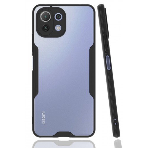 Newface Xiaomi Mİ 11 Lite Kılıf Platin Silikon - Siyah Newface Xiaomi Mİ 11 Lite Kılıf Platin Silikon - Siyah