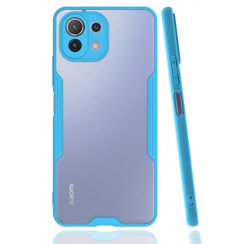 Newface Xiaomi Mİ 11 Lite Kılıf Platin Silikon - Mavi Newface Xiaomi Mİ 11 Lite Kılıf Platin Silikon - Mavi