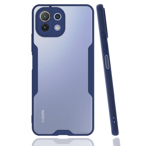 Newface Xiaomi Mİ 11 Lite Kılıf Platin Silikon - Lacivert Newface Xiaomi Mİ 11 Lite Kılıf Platin Silikon - Lacivert