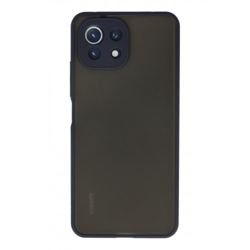 Newface Xiaomi Mİ 11 Lite Kılıf Montreal Silikon Kapak - Lacivert Newface Xiaomi Mİ 11 Lite Kılıf Montreal Silikon Kapak - Lacivert