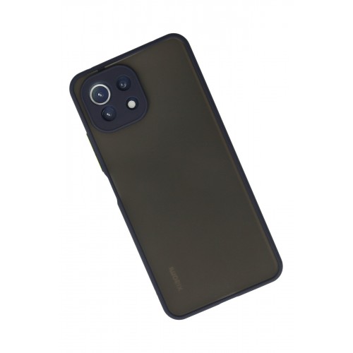 Newface Xiaomi Mİ 11 Lite Kılıf Montreal Silikon Kapak - Lacivert Newface Xiaomi Mİ 11 Lite Kılıf Montreal Silikon Kapak - Lacivert