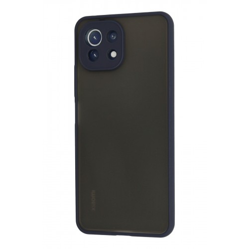 Newface Xiaomi Mİ 11 Lite Kılıf Montreal Silikon Kapak - Lacivert Newface Xiaomi Mİ 11 Lite Kılıf Montreal Silikon Kapak - Lacivert
