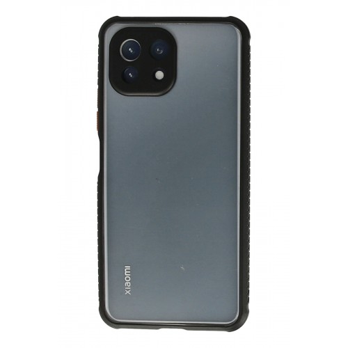 Newface Xiaomi Mİ 11 Lite Kılıf Miami Şeffaf Silikon  - Siyah