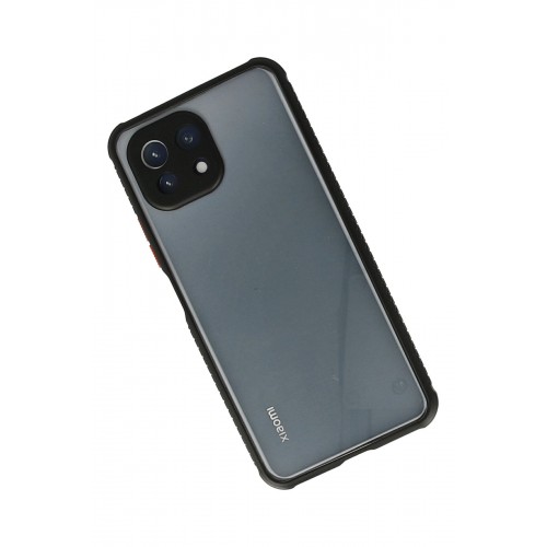 Newface Xiaomi Mİ 11 Lite Kılıf Miami Şeffaf Silikon - Siyah Newface Xiaomi Mİ 11 Lite Kılıf Miami Şeffaf Silikon - Siyah