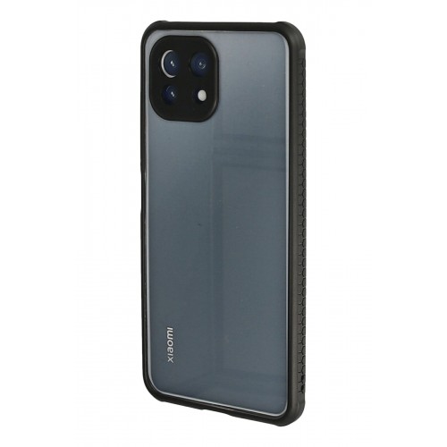 Newface Xiaomi Mİ 11 Lite Kılıf Miami Şeffaf Silikon - Siyah Newface Xiaomi Mİ 11 Lite Kılıf Miami Şeffaf Silikon - Siyah