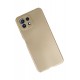 Newface Xiaomi Mİ 11 Lite Kılıf Premium Rubber Silikon - Gold Newface Xiaomi Mİ 11 Lite Kılıf Premium Rubber Silikon - Gold
