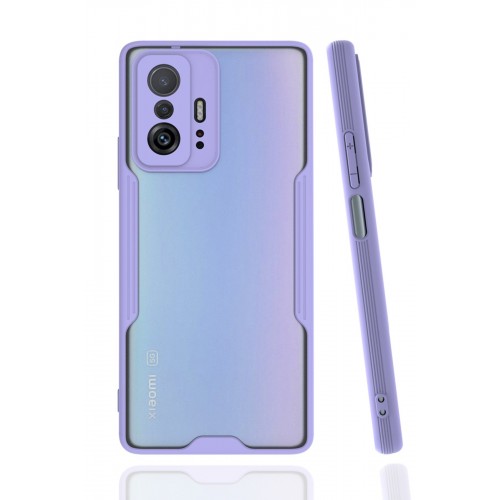 Newface Xiaomi Mi 11T Pro Kılıf Platin Silikon - Lila Newface Xiaomi Mi 11T Pro Kılıf Platin Silikon - Lila