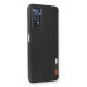 Newface Xiaomi Redmi Note 11 Pro Kılıf Loop Deri Silikon - Siyah Newface Xiaomi Redmi Note 11 Pro Kılıf Loop Deri Silikon - Siyah
