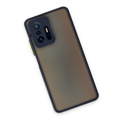 Newface Xiaomi Mi 11T Pro Kılıf Montreal Silikon Kapak - Lacivert Newface Xiaomi Mi 11T Pro Kılıf Montreal Silikon Kapak - Lacivert