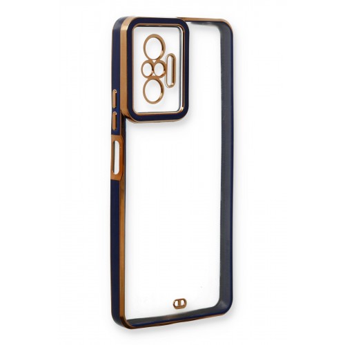 Newface Xiaomi Redmi Note 10 Pro Kılıf Liva Lens Silikon - Mavi Newface Xiaomi Redmi Note 10 Pro Kılıf Liva Lens Silikon - Mavi
