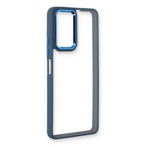 Newface Xiaomi Redmi Note 11S Kılıf Dora Kapak - Mavi Newface Xiaomi Redmi Note 11S Kılıf Dora Kapak - Mavi