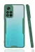 Newface Xiaomi Redmi Note 11 Pro Plus 5G Kılıf Platin Silikon - Yeşil