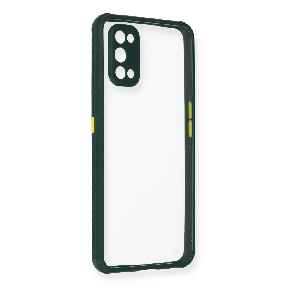 Newface Realme 7 Pro Kılıf Miami Şeffaf Silikon - Koyu Yeşil