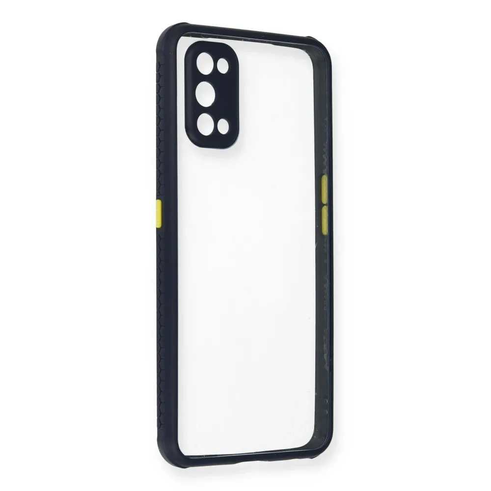 Newface Realme 7 Pro Kılıf Miami Şeffaf Silikon - Lacivert