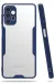 Newface Samsung Galaxy A72 Kılıf Platin Silikon - Lacivert