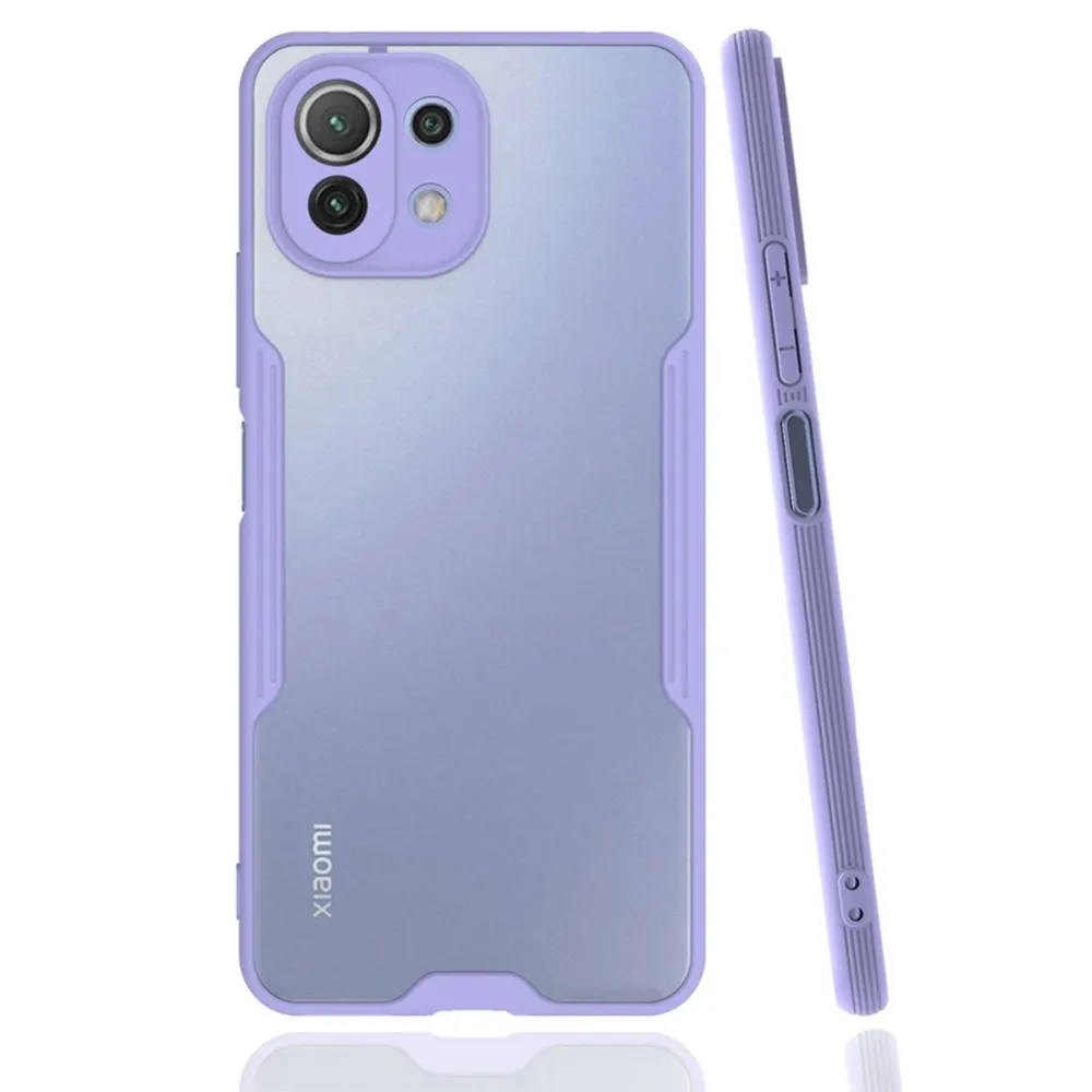 Newface Xiaomi Mi 11 Lite Kılıf Platin Silikon - Lila