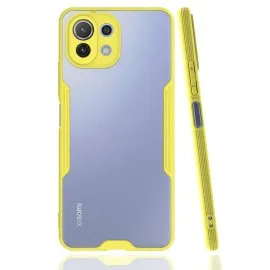 Newface Xiaomi Mi 11 Lite Kılıf Platin Silikon - Sarı
