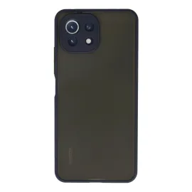 Newface Xiaomi Mi 11 Lite Kılıf Montreal Silikon Kapak - Lacivert