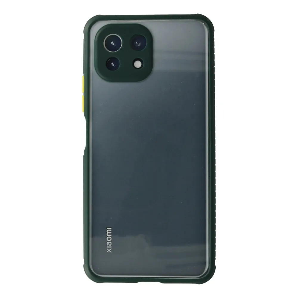 Newface Xiaomi Mi 11 Lite Kılıf Miami Şeffaf Silikon - Koyu Yeşil