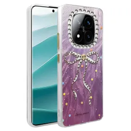 Newface Xiaomi Redmi Note 14 Pro 5G Kılıf Blade Aynalı Desenli Kapak - Desen 1