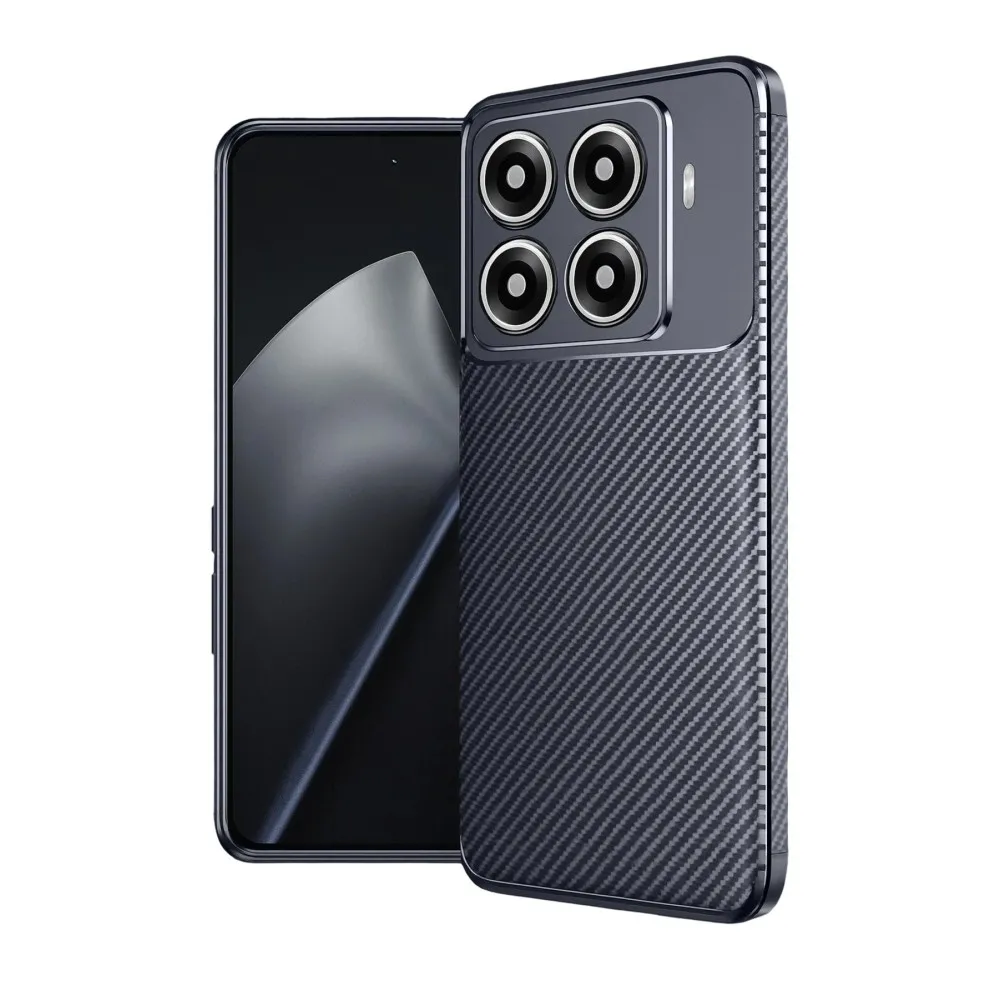 Newface Xiaomi Mi 15T Pro Auto Focus Karbon Kapak - Lacivert