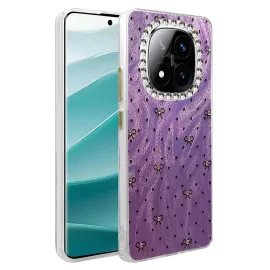 Newface Xiaomi Redmi Note 14 Pro 4G Kılıf Blade Aynalı Desenli Kapak - Desen 2