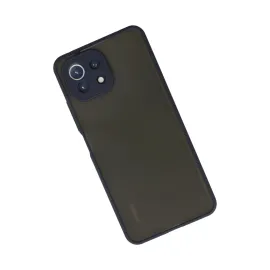 Newface Xiaomi Mi 11 Lite Kılıf Montreal Silikon Kapak - Lacivert
