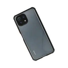 Newface Xiaomi Mi 11 Lite Kılıf Miami Şeffaf Silikon - Siyah