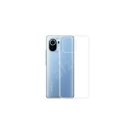 Newface Xiaomi Mi 11 Kılıf Lüx Şeffaf Silikon
