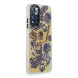 Newface Xiaomi Redmi Note 11 Pro Kılıf Estoril Desenli Kapak - Estoril - 13