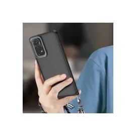 Newface Xiaomi Redmi Note 11 Kılıf Elegant Kapak - Pudra