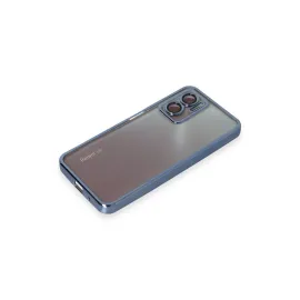 Newface Xiaomi Redmi Note 11E Kılıf Razer Lensli Silikon - Açık Mavi