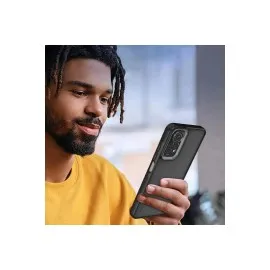 Newface Xiaomi Redmi Note 11 Kılıf Elegant Kapak - Pudra