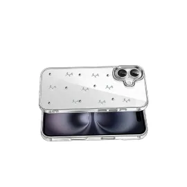 Newface Apple Iphone 16 Plus Fiyonk Desenli Kapak - Desen 4