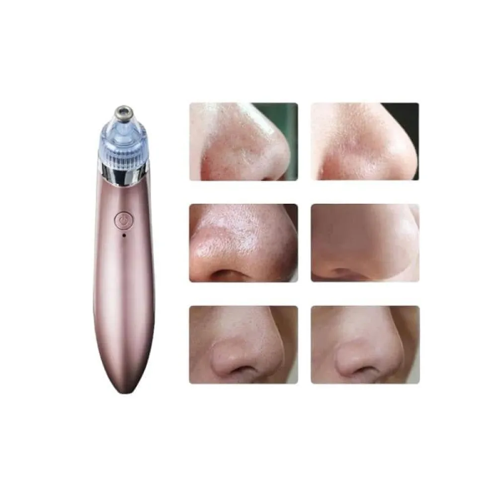 SİYAH NOKTA CİHAZI